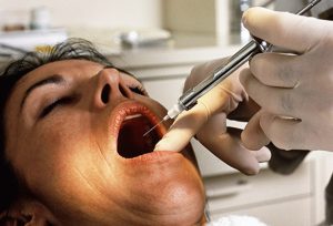 from https://www.webmd.com/oral-health/ss/slideshow-wisdom-teeth