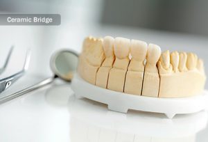 from https://www.webmd.com/oral-health/ss/slideshow-tmj-tmd-overview