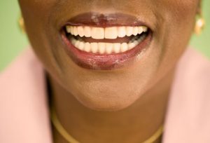 from https://www.webmd.com/oral-health/ss/slideshow-bright-smile