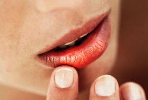 from https://www.webmd.com/oral-health/ss/slideshow-dry-mouth