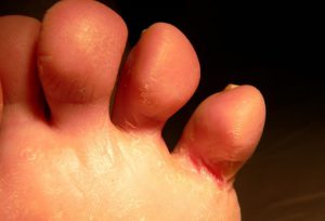 from https://www.webmd.com/diabetes/ss/slideshow-what-your-feet-say