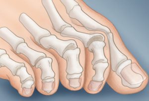 from https://www.webmd.com/diabetes/ss/slideshow-what-your-feet-say