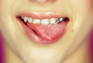 from https://www.webmd.com/oral-health/ss/slideshow-teeth-wreckers