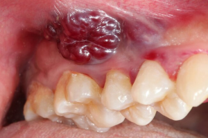 from https://www.webmd.com/oral-health/ss/conditions-teeth-hurt