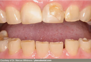 from https://www.webmd.com/oral-health/ss/slideshow-teeth-gums