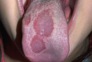 from https://www.webmd.com/oral-health/ss/slideshow-mouth-problems