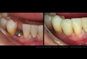 from https://www.webmd.com/oral-health/ss/slideshow-cosmetic-dentistry