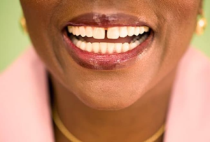 from https://www.webmd.com/oral-health/ss/slideshow-tooth-problems