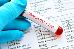 from https://www.webmd.com/vitamins-and-supplements/ss/slideshow-signs-lack-vitamin-b12