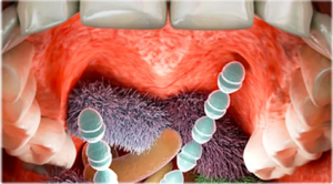 from https://www.webmd.com/oral-health/rm-quiz-germs-your-mouth